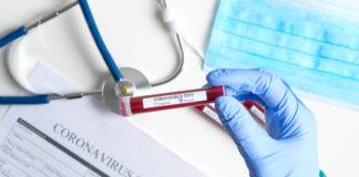 177 νέα κρούσματα στην χώρα – 1 στην ΠΕ Ξάνθης – Η γεωγραφική κατανομή