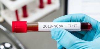 12 κρούσματα στην ΠΕ Ξάνθης – 87 στην ΑΜΘ – Δείτε τον σημερινό «χάρτη» του κορωνοϊού