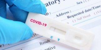 Σκέρτσος : Δωρεάν τεστ κορωνοϊού για όλους κάθε εβδομάδα από τα φαρμακεία