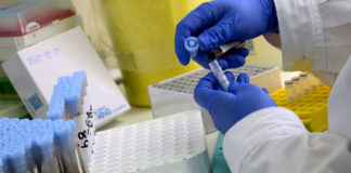 Θετικό κρούσμα κορωνοϊού στην ομάδα του ΑΟΞ – Βρίσκεται σε κατ΄οίκον περιορισμό