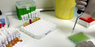 Γιατί δε χρειάζεται PCR για να βγούμε από την καραντίνα