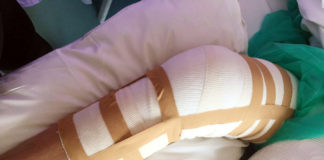 Έρανος από τα «Αδεσποτούλια» για στήριξη συμπολίτη