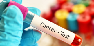 Γιατροί αποκαλύπτουν ανησυχητικό λόγο για την αλματώδη αύξηση των καρκίνων του εντέρου στους νέους