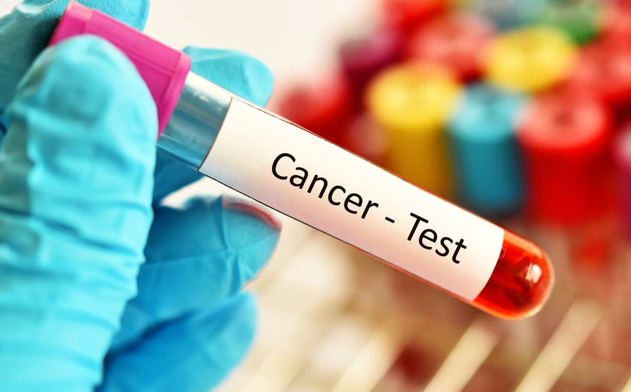 test-cancer-igeia
